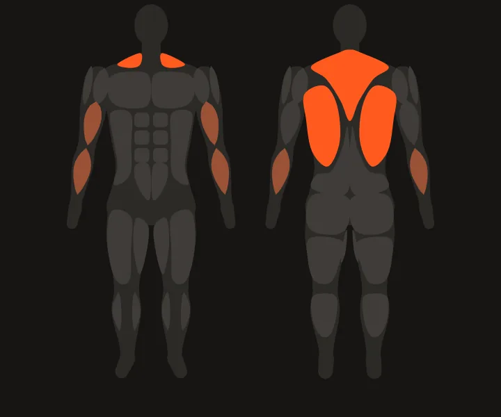 Muskelkarte: Latissimus, oberer Rücken